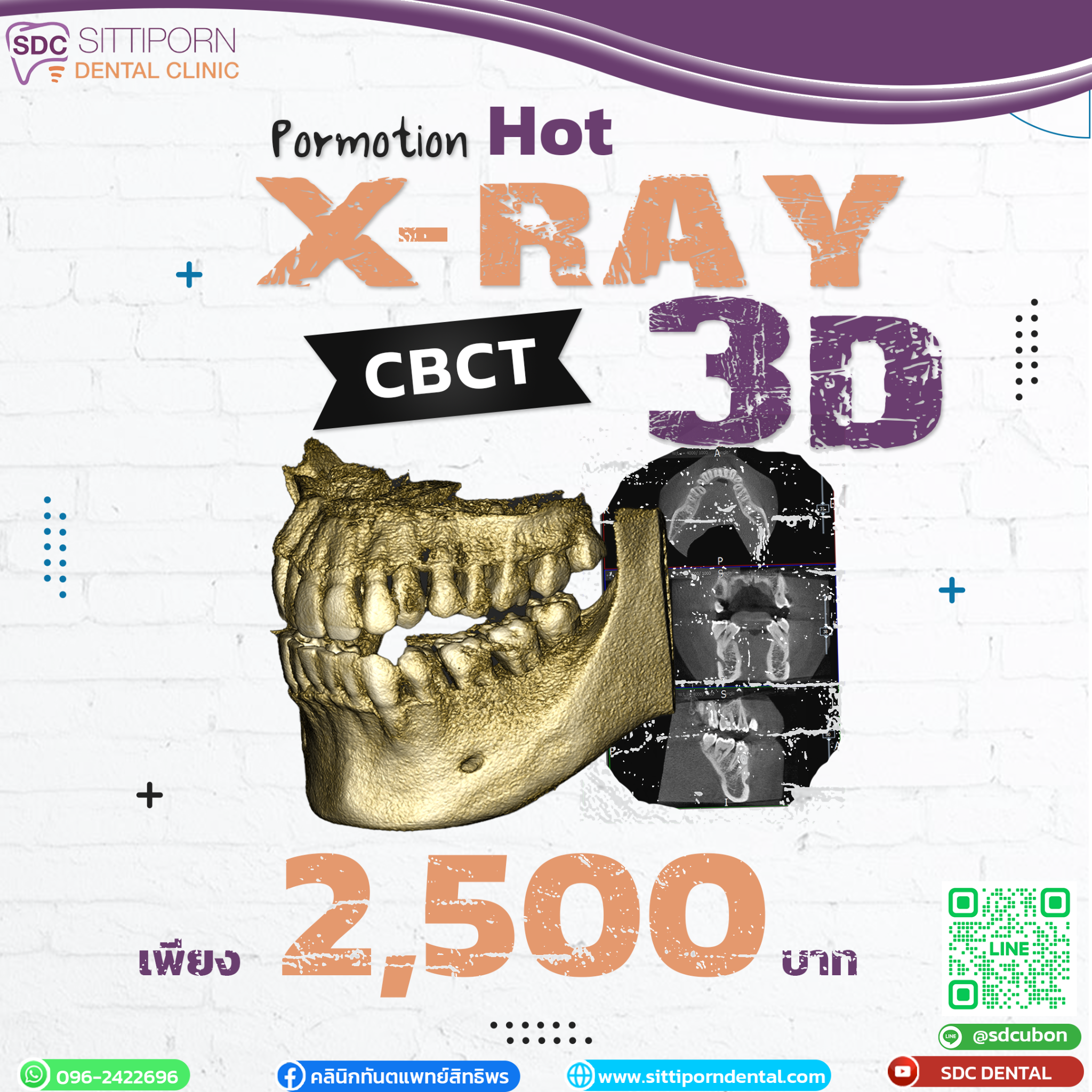 CBCT X-RAY 3D SDC