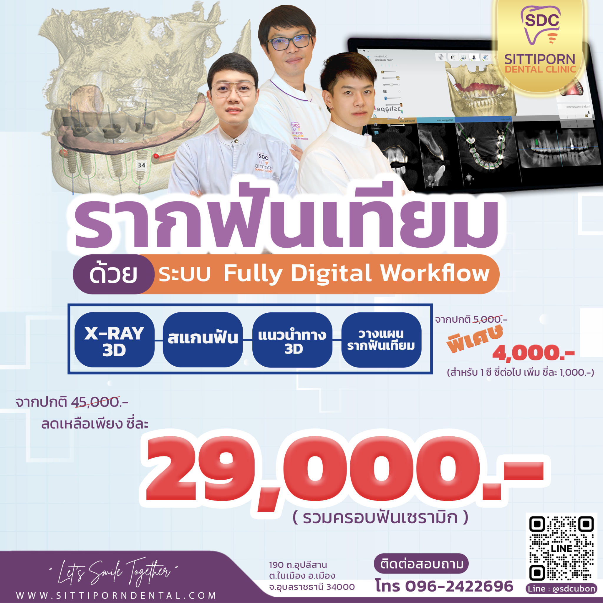 โปรโมชั่น รากฟันเทียม SDC