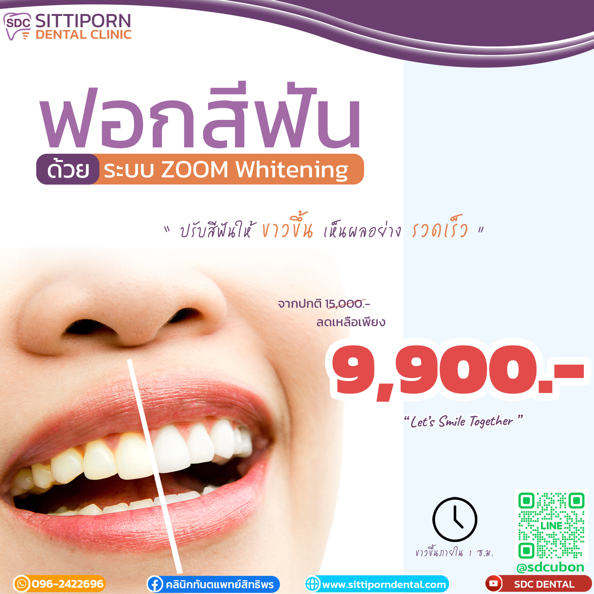 ฟอกสีฟัน ZOOM Whitening SDC